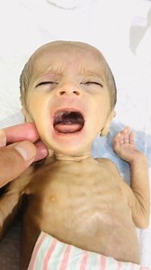 Learn about premature baby care, development, and health challenges. Get expert advice and support for navigating the NICU journey." 2. "Discover what to expect when your baby is born prematurely. Understand the medical needs, developmental milestones, and parenting tips." 3. "Premature birth can be overwhelming, but with the right guidance, you can provide the best care for your baby. Learn more about premature baby care and development." 4. "Premature babies require special care and attention.