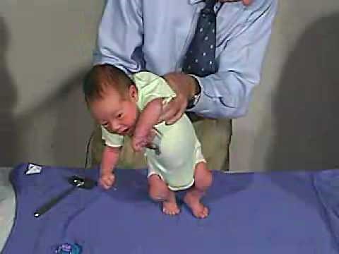 physical exam -Newborn Normal: Primitive Reflexes - Stepping