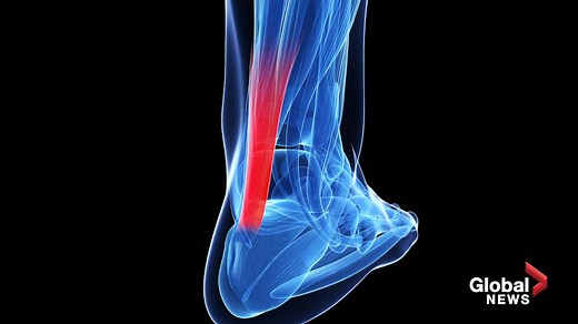 What is an Achilles injury?