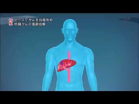 治る最前線「肝臓がんの最新治療」