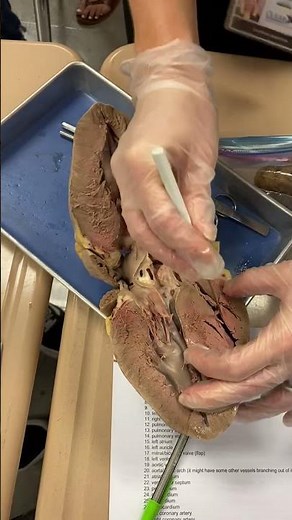 Pig Heart dissection: Internal Structures