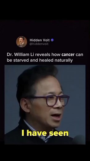 Dr. William Li is a renowned #cancer specialist, scietist and physician. He #reveals cancer can be starved naturally by cutting off the blood supply #tumors need to grow. Short-term starvation is much more effective in protecting normal cells against chemotherapy drugs compared to dietary restriction. Autophagy is a conserved process of self-eating adopted by cells in response to starvation and other stressed conditions. The core idea is based on the difference in how normal cells and most cance