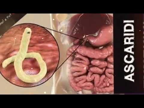 Ascaridiasi vermi intestinali ascaridi famiglia vermi Tondi