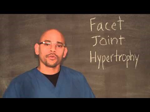 Facet Joint Hypertrophy Explained