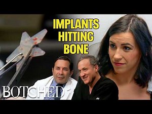 Ribcage Implants?! Ashlea's Extreme Body Mods Put Her Health At Risk (Before & After) | Botched | E!