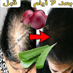 5.6K views · 60 reactions | White hair to black hair naturally in just 3 minutes and grow long hair fast with onion & alovera #hair #blackhair #longhair #blacklonghair | Natural Recipes Tv | Facebook