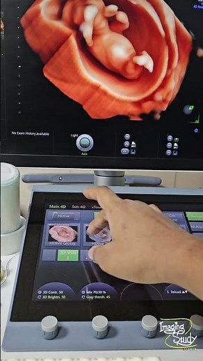 57 || 3D Pregnancy Tutorial || Ultrasound