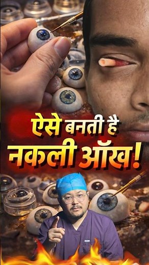 Artificial Eye Making Process | Doctor Explains