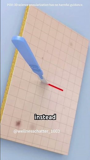 How Surgeons Use Z-Plasty & V-Y Plasty to Fix Scars? (3D Animation)#zplasty #yplasty #scarfix