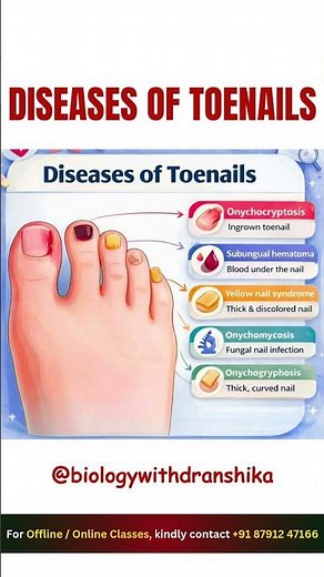 Diseases of Toenails 👣🦠 #toenails #disease #foothealth #nailcare #fungalnail #ingrowntoenails