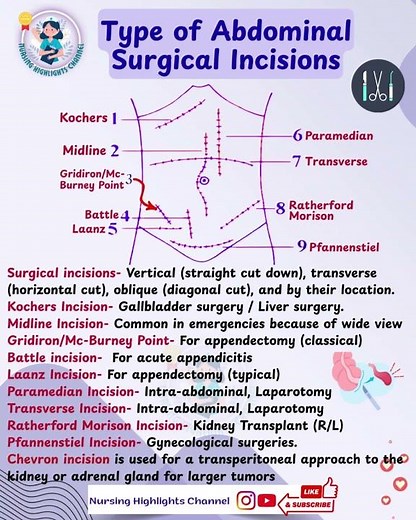 🔪 Abdominal Incisions #norcet #aiims #kgmu #gmch #sgpgi #emergency #nursinghighlightschannel