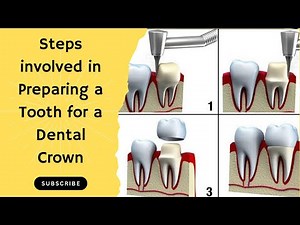 Steps involved in Preparing a Tooth for a Dental Crown