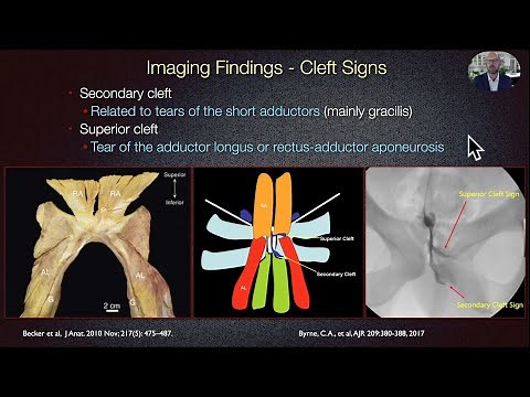 Groin Pain in Athletes - 10 Minute Version