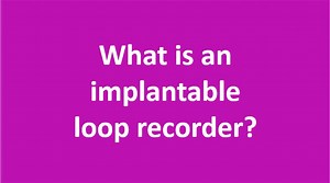 What is an implantable loop recorder? - All About Heart And Blood Vessels