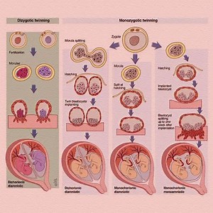 👶 Twin Facts 👯 Identical twins = 1 egg split, always same sex 👩‍👩‍👧 Fraternal twins = 2 eggs, like siblings 🌀 Identical twins don’t share fingerprints 🔄 Mirror twins = opposite traits (like left vs right handed) 🎂 Twins can be born on different days/years #Twins #FunFacts #Science #Genetics #DidYouKnow #pregnancy #pregnancyjourney | Mum_world_