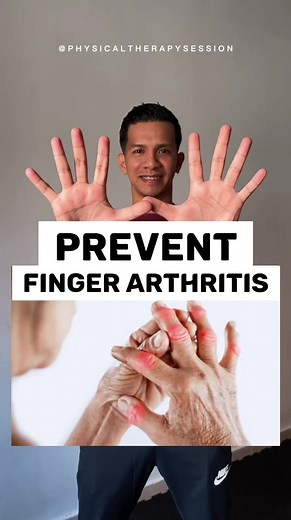 22K views · 775 reactions | Finger exercises to prevent arthritis! FOLLOW FOR MORE REMEDY TIPS! #fingerchallenge #arthritis #arthritisrelief #arthritispain #fypシ゚ #virals #trendingnow #physiotherapist #physicaltherapist #physicaltherapysession #follownow #ShareThisPost #SharePost #LikeAndShare | Physical Therapy Session | Facebook