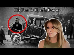 His Face Is Upside Down ! || The Man With The Upside Down Face