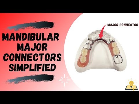 Mandibular Major Connectors | Removable Partial Denture (RPD)