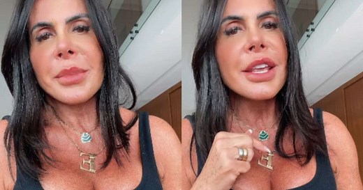 Gretchen mostra rosto novo depois de procedimento estético: ‘Mais fino e delicado’