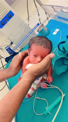 Cute Newborn Baby Burping After Feeding | Parenting Tips Newborn baby burping after milk feeding 🍼💤 Burping helps babies digest properly and keeps them healthy. A must-watch for new parents looking for baby care and parenting tips. 💖👶 #BabyBurping #NewbornBaby #CuteBaby #BabyCare #BabyFeeding #ParentingTips #InfantCare #BabyLove #MotherCare #BabyHealth | Little Angel Care