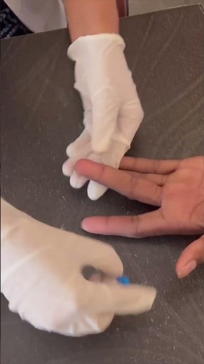 How to prick finger tip with a lancet correctly? #laboratory #lancet #fingertips #viralshorts