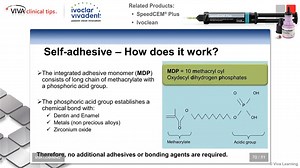 Dr. DiTolla on SpeedCEM Plus and Ivoclean | ADVANCED DENT