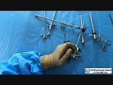 How to Use Hysteroscopy Instruments? • Video • MEDtube.net