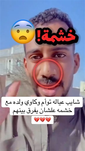 اولادة توأم وكاوي واحد من اولادة بخشمة!! 😂😂 #youtubeshorts