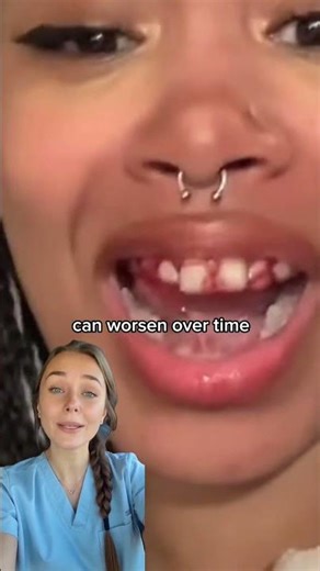 Can retainers damage teeth?