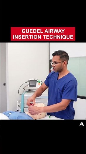 Guedel Airway Insertion Technique | #anesthesia #bagmaskventilation #airway