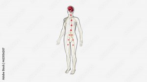 Central sensitization, the process by which the central nervous system processes pain and other sensory stimuli