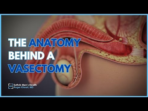 The Anatomy and Procedure of a Vasectomy | A Doctor’s Guide by Dr. Roger Khouri