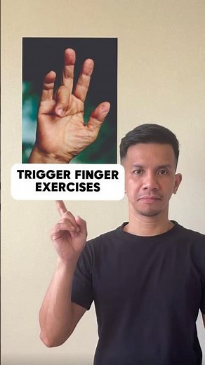 TRIGGER FINGER EXERCISES 🤩🤩🤩 #triggerfinger #viral #amazing