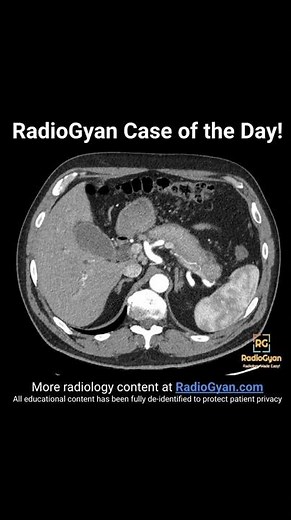 What is your diagnosis for this case?