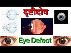 Human eye : Types of defects ( दृष्टीदोष प्रकार ) इयत्ता 10 वी प्रकरण 7