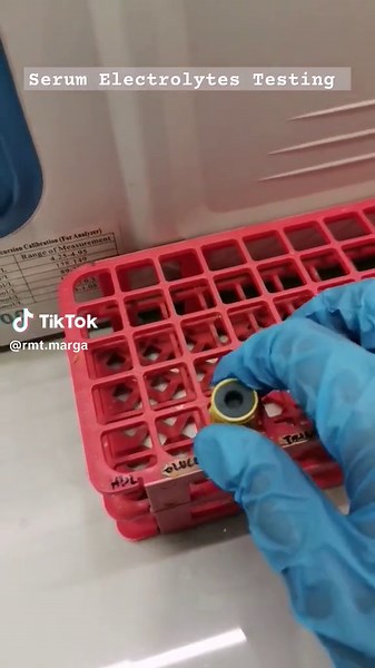 Serum Electrolytes Test: Understanding Sodium, Potassium, and More