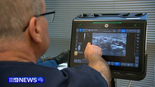 Victorian doctor pioneers revolutionary carpal tunnel procedure