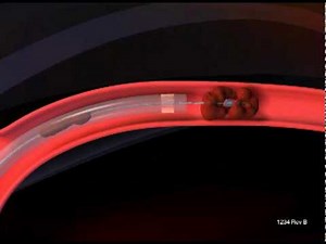 Penumbra System Animation