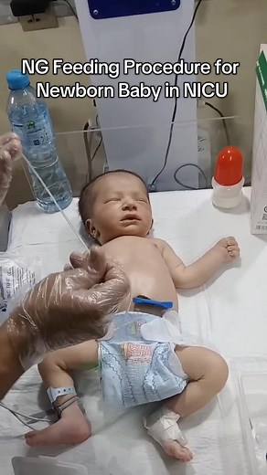 NG Feeding Procedure for Newborn Baby in NICU _ Baby Boy _ Step-by-Step Guide #newborn #preterm #babycare #usa #unfreezmyaccount