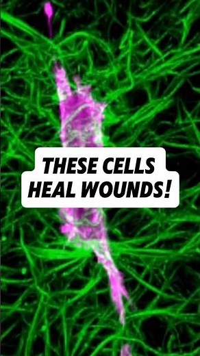 Wound healing cells (fibroblasts) movement patterns caught on camera!#microbiology #biology #science