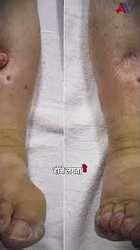 How High Heels Affect Your Blood Flow