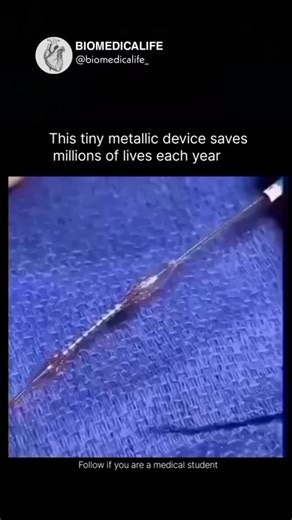 biomedical on Instagram: "This tiny, metallic mesh tube is a coronary stent, and it truly saves millions of lives annually. It's collapsed onto a balloon catheter and then guided into a blocked artery in the heart. Once expanded, it acts as a permanent scaffold to keep the artery open, restoring blood flow and preventing heart attacks. Modern medicine is incredible.#fypシ゚シ #reels#education #instagram #viral#ScienceDaily #Biology #BiomedicalLife #Biomedica . . 日本利用压电瓷砖将脚步转化为电能。这些瓷砖捕获您脚步中的动能。当您行走时