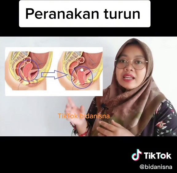 Derajat Prolaps Uteri: Apa itu dan Cara Mengatasinya