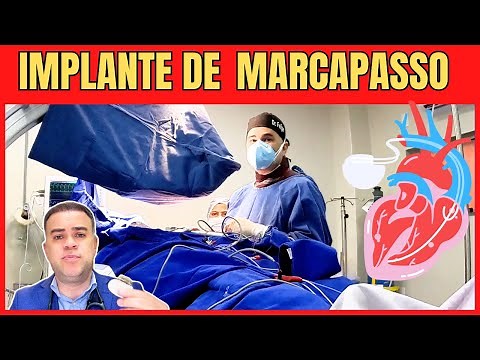 ASSISTA uma CIRURGIA de implante de MARCAPASSO BICAMERAL