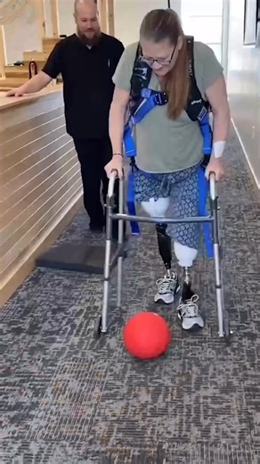 138K views · 1.1K reactions | Prosthetic gait training is crucial for...