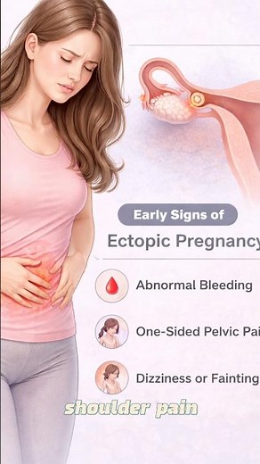 Early signs of Ectopic Pregnancy