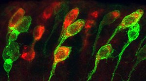 Claudia Barros Lab – Neural Stem Cells and Brain Tumourigenesis Research