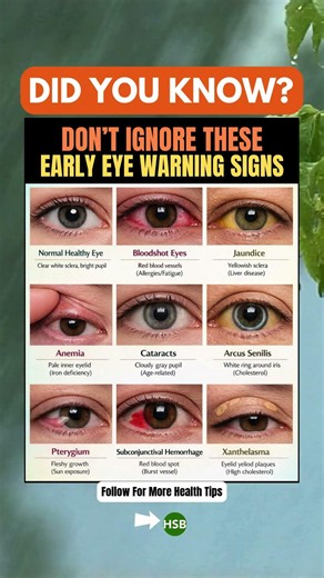 👁️ Check Your Eyes After Seeing This
