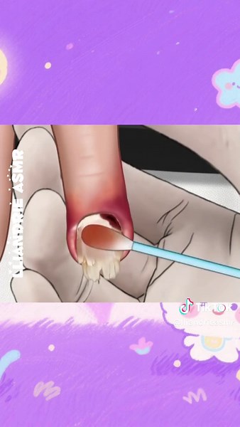 Accessorize Your Nails and Rings for Style