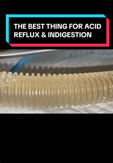 Effective Colon Cleansing for Acid Reflux Relief